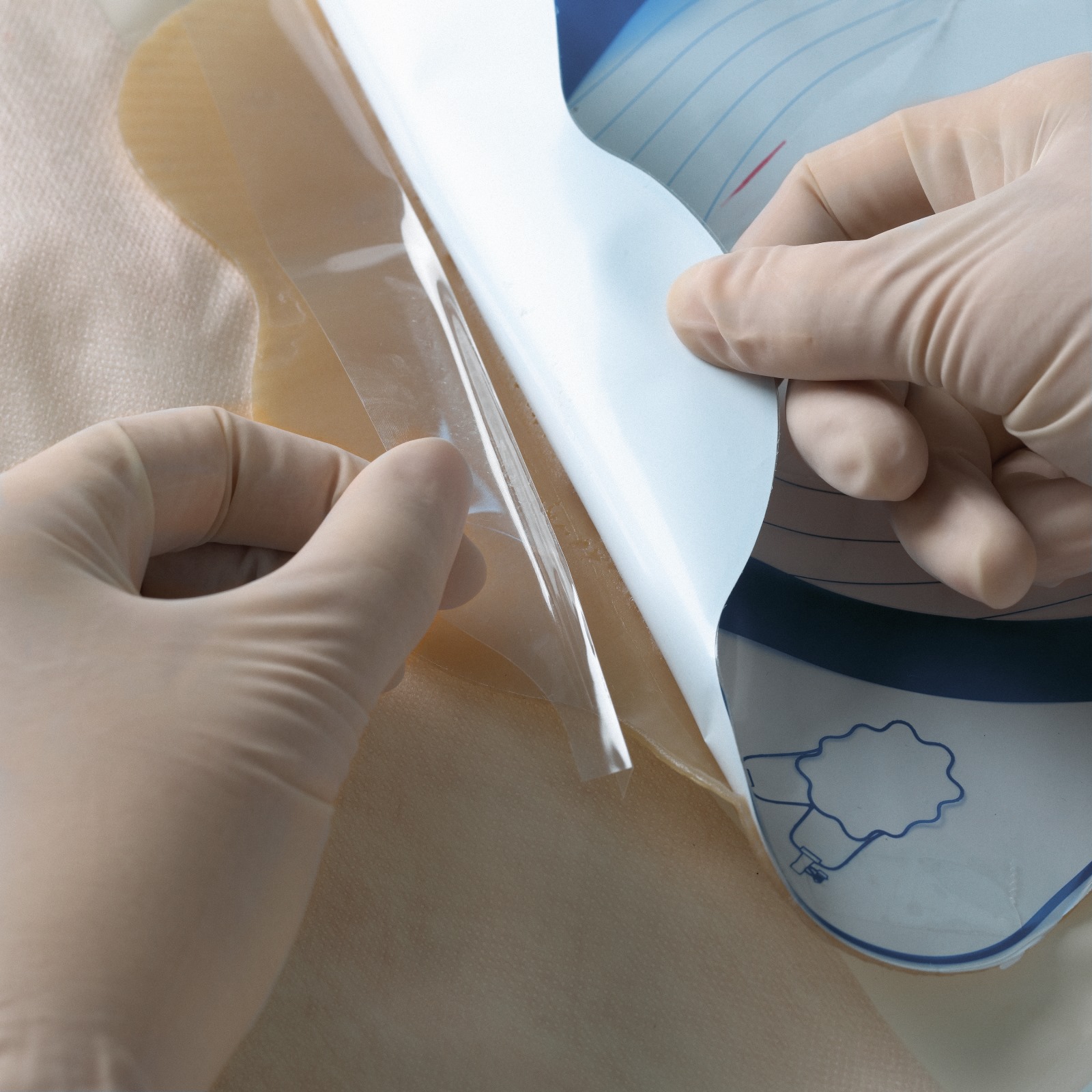 Sac colector cu evacuare pentru fistule Sac colector cu evacuare pentru fistule